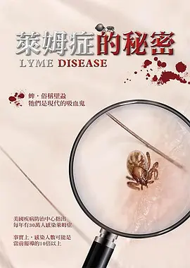 莱姆症的秘密 海报 高清在线观看