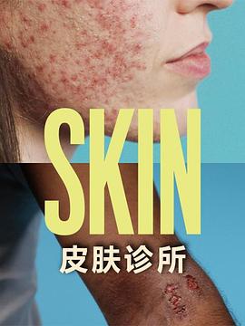 皮肤诊所 海报 高清在线观看
